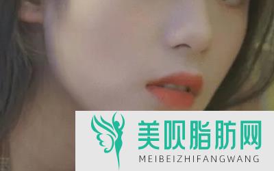 玻尿酸隆鼻果的影响因素,伊婉v型玻尿酸隆鼻变宽怎么办