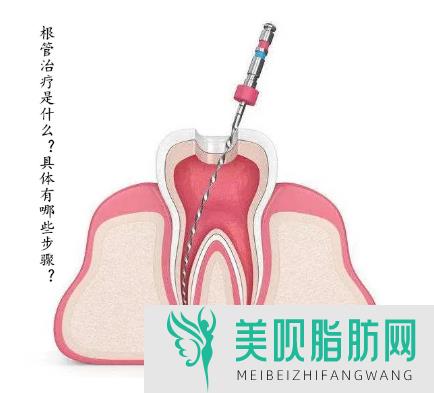 解答一下北京矫正牙齿一般要多少钱