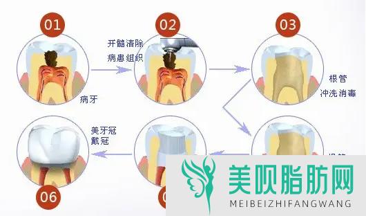 小编告诉你长沙做矫正牙齿的价格是多少,长沙矫正牙齿一般多少钱