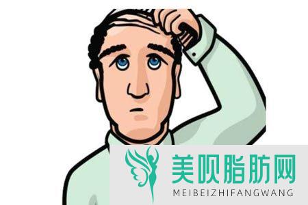 无锡正规植发医院有哪些(无锡哪个医院可以植发)