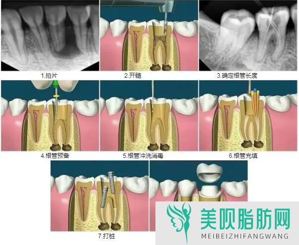 南昌牙齿矫正哪家医院好(南昌牙齿矫正哪家医院好)