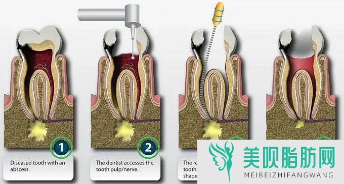 「分析」昆明牙齿矫正价格多少钱一颗,昆明牙齿矫正价格多少钱