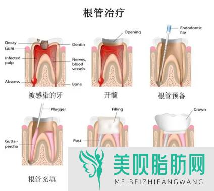 「揭秘」深圳牙科医院哪家好知乎,深圳牙科医院哪家好