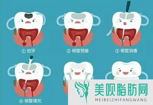 「快讯」秦皇岛牙齿矫正多少钱,揭秘秦皇岛暑期学生牙齿矫正价格