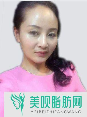 上海明慨医疗美容门诊部杨晓娥